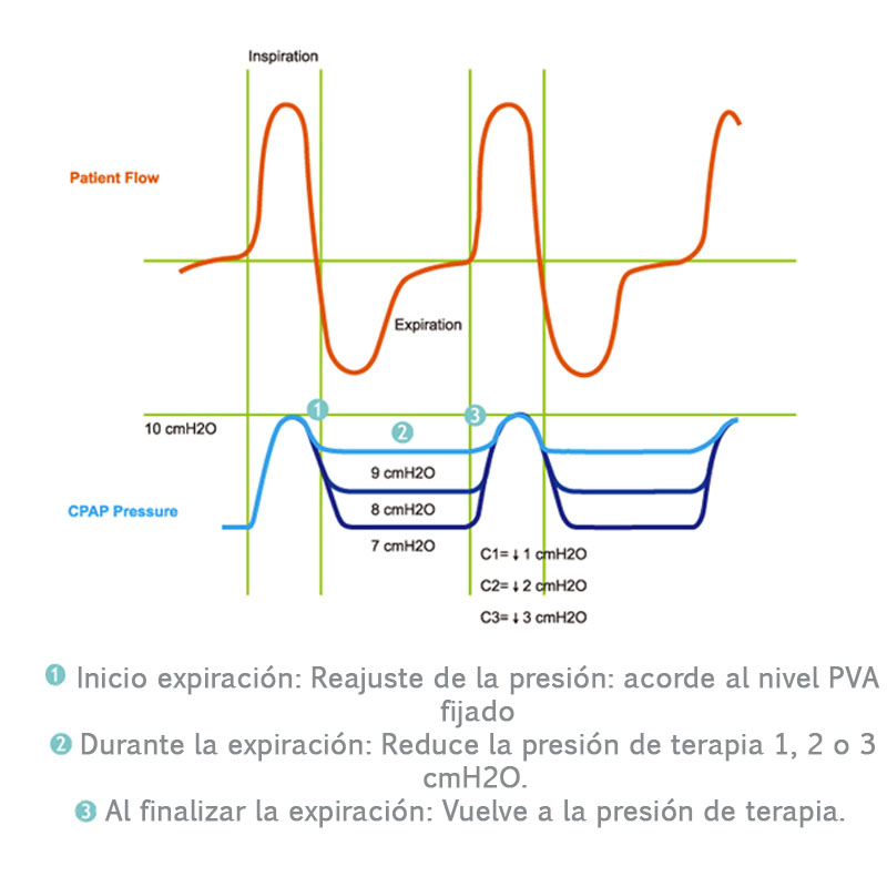 Otras Características